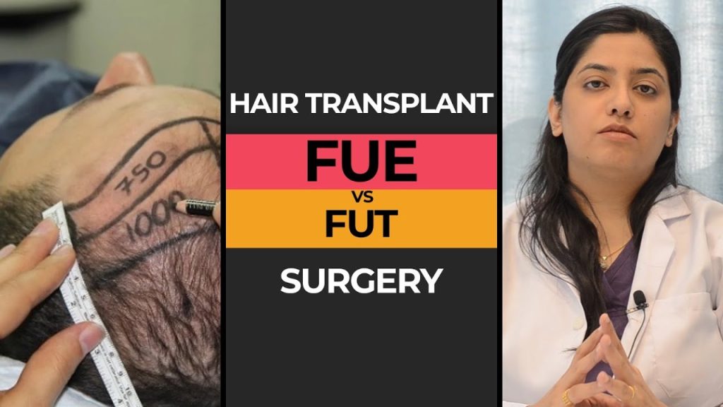 Best Hair Transplant Clinic in Karachi – Comprehensive Guide